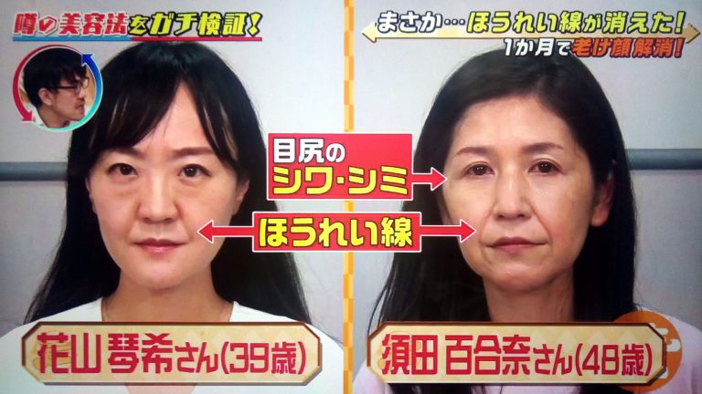 【この差って何ですか？】ほうれい線を消す美容法で老け顔が解消できるかガチ検証