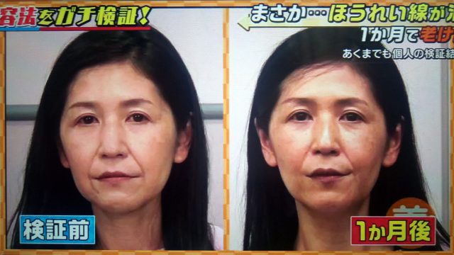 【この差って何ですか？】ほうれい線を消す美容法で老け顔が解消できるかガチ検証